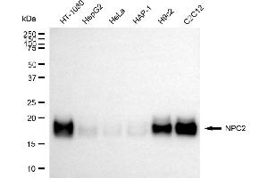 Western blotting analysis using NPC2 antibody (ABIN7799599).