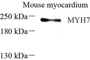 Western blot analysis of MYH7 (ABIN7075623),at dilution of 1: 600