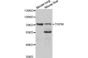 Western Blotting (WB) image for anti-Transforming Growth Factor, beta-Induced, 68kDa (TGFBI) antibody (ABIN1875076) (TGFBI 抗体)
