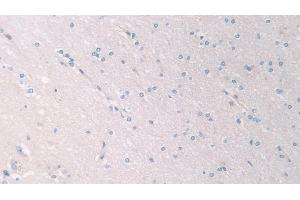 Immunohistochemistry (IHC) image for anti-Pantothenate Kinase 4 (PANK4) (AA 639-773) antibody (ABIN7436114)