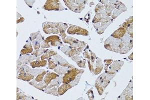 Immunohistochemistry of paraffin-embedded Mouse heart using MRPS6 Polyclonal Antibody at dilution of 1:100 (40x lens). (MRPS6 抗体)