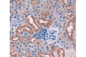 Used in DAB staining on fromalin fixed paraffin- embedded kidney tissue (CDK18 抗体  (AA 121-402))