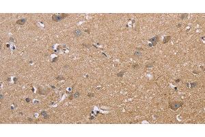 Immunohistochemistry of paraffin-embedded Human brain using MAPRE3 Polyclonal Antibody at dilution of 1:50 (MAPRE3 抗体)