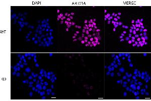 Immunocytochemical staining of Hela cells using ARID1A antibody (ABIN7797666), 1:1,000), Top panel: wild-type (WT), Bottom panal: ARID1A shRNA knockdown (KD). (Recombinant ARID1A 抗体)