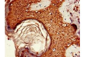 Immunohistochemistry of paraffin-embedded human skin tissue using ABIN7164755 at dilution of 1:100