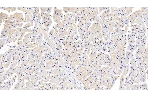 Detection of ITGa11 in Human Cardiac Muscle Tissue using Polyclonal Antibody to Integrin Alpha 11 (ITGa11) (ITGA11 抗体)