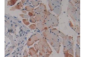 Detection of Flt3 in Mouse Skeletal muscle Tissue using Polyclonal Antibody to FMS Like Tyrosine Kinase 3 (Flt3) (FLT3 抗体  (AA 335-544))