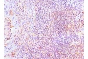 Immunohistochemistry of paraffin-embedded human tonsil tissue using ABIN7158655 at dilution of 1:100 (LSP1 抗体  (AA 1-339))
