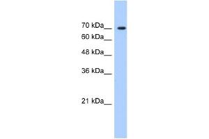 WB Suggested Anti-LAS1L Antibody   Titration: 1. (LAS1L 抗体  (C-Term))