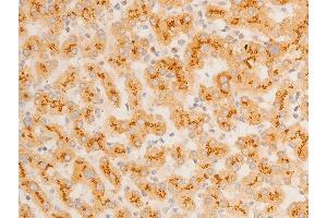 ABIN6267219 at 1/100 staining human liver tissue sections by IHC-P.