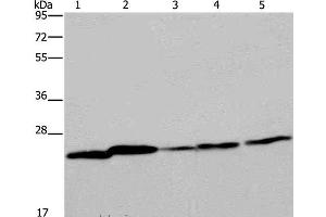 Western Blot analysis of Mouse spleen tissue, A375, A549, HT-29 and Hela cell using ARHGDIA Polyclonal Antibody at dilution of 1:350 (ARHGDIA 抗体)