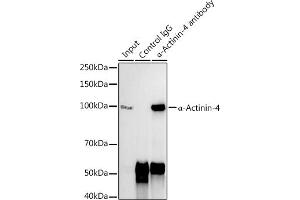 Immunoprecipitation analysis of 300 μg extracts of 293T cells using 3 μg α-Actinin-4 antibody (ABIN7265399). (alpha Actinin 4 抗体)