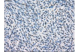 Immunohistochemical staining of paraffin-embedded colon tissue using anti-SLC2A6mouse monoclonal antibody.