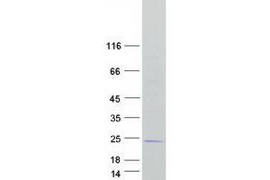 Western Blotting (WB) image for Centromere Protein A (CENPA) (Transcript Variant 1) protein (Myc-DYKDDDDK Tag) (ABIN2713905)