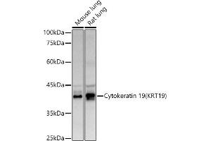 Western blot analysis of extracts of various cell lines, using Cytokeratin 19 (KRT19) antibody (ABIN3020778, ABIN3020779, ABIN3020780 and ABIN6213719) at 1:500 dilution. (Cytokeratin 19 抗体  (AA 241-400))