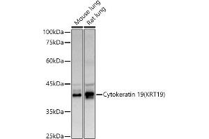 Western blot analysis of extracts of various cell lines, using Cytokeratin 19 (KRT19) antibody (ABIN3020778, ABIN3020779, ABIN3020780 and ABIN6213719) at 1:500 dilution.