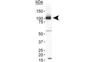 Western blot analysis of TRPA1 in human brain membrane fraction with TRPA1 polyclonal antibody at 2 ug/mL . (TRPA1 抗体  (AA 1-100))