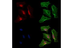 Phospho-Bcl6 (Ser333) Antibody staining A549 cells(heat shock treatment) by IF/ICC. (BCL6 抗体  (pSer333))