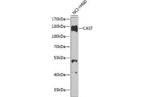 Western blot analysis of extracts of H460 cells, using CAST antibody (ABIN3015047, ABIN3015048, ABIN5663576 and ABIN6213614) at 1:1000 dilution. (Calpastatin 抗体  (C-Term))