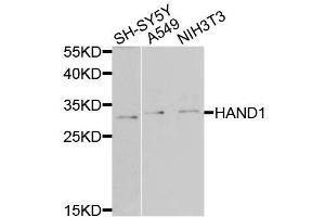 Western blot analysis of extracts of various cell lines, using HAND1 antibody (ABIN6003587) at 1/1000 dilution. (HAND1 抗体)