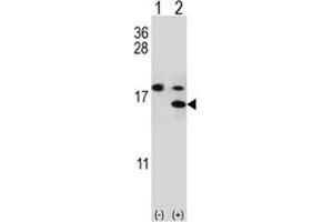 Western blot analysis of S100A11 antibody and 293 cell lysate either nontransfected (Lane 1) or transiently transfected (2) with the S100A11 gene. (S100A11 抗体  (AA 1-30))