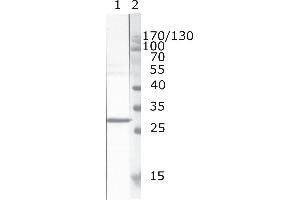 Western Blot testing of HIV-1 recombinant Nef protein. (HIV-1 Nef (AA 171-190) 抗体)