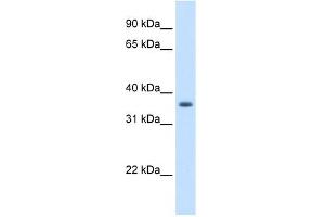 AKR1B10 antibody used at 1. (AKR1B10 抗体)