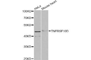 Western blot analysis of extracts of various cell lines, using TNFRSF10D antibody (ABIN5973614) at 1/1000 dilution. (DcR2 抗体)