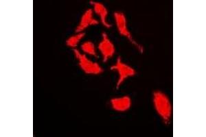 Immunofluorescent analysis of Cullin 4A staining in U2OS cells. (Cullin 4A 抗体)