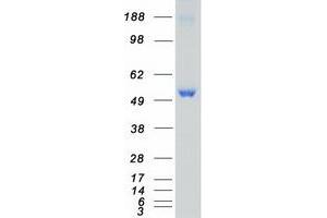 Western Blotting (WB) image for Calcium/calmodulin-Dependent Protein Kinase II delta (CAMK2D) (Transcript Variant 2) protein (Myc-DYKDDDDK Tag) (ABIN2713091)