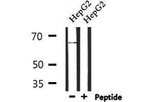Western blot analysis of extracts from HepG2, using ATIC Antibody. (ATIC 抗体  (C-Term))