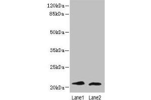 Western blot All lanes: LRRC20 antibody at 1 μg/mL Lane 1: Jurkat whole cell lysate Lane 2: Mouse spleen tissue Secondary Goat polyclonal to rabbit IgG at 1/10000 dilution Predicted band size: 21, 15 kDa Observed band size: 21 kDa (LRRC2 抗体  (AA 1-184))