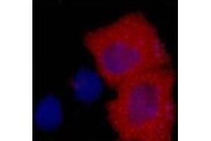 Immunofluorescence analysis of 293 cells transfected with a HA tag protein tissue using HA-Tag Monoclonal Antibody at dilution of 1:2000. (HA-Tag 抗体)