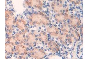 Immunohistochemistry (IHC) image for anti-Activating Transcription Factor 7 (ATF7) (AA 50-270) antibody (ABIN7441865)