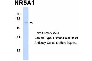 Western Blotting (WB) image for anti-Nuclear Receptor Subfamily 5, Group A, Member 1 (NR5A1) (Middle Region) antibody (ABIN2777447)