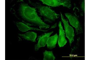 Immunofluorescence of monoclonal antibody to PAK1 on HeLa cell. (PAK1 抗体  (AA 191-280))