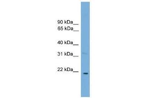 Western Blot showing CTF1 antibody used at a concentration of 1-2 ug/ml to detect its target protein. (Cardiotrophin 1 抗体  (N-Term))