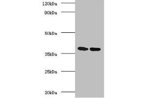 Western blot All lanes: Antigen 85-A antibody at 2 μg/mL Lane 1: Recombinant Mycobacterium tuberculosis Antigen 85-A protein 1 μg Lane 2: Recombinant Mycobacterium tuberculosis Antigen 85-A protein 10 μg Secondary Goat polyclonal to rabbit IgG at 1/10000 dilution Predicted band size: 36 kDa Observed band size: 36 kDa (FBPA (AA 53-331) 抗体)