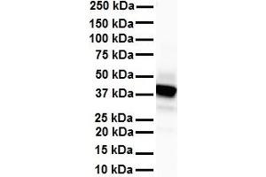 WB Suggested Anti-SLC6A5 antibody Titration: 1 ug/mL Sample Type: Human heart (SLC6A5 抗体  (N-Term))