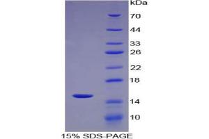 SDS-PAGE analysis of Mouse PLA2G2D Protein. (PLA2G2D 蛋白)