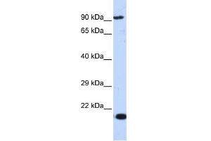 WB Suggested Anti-MCM7 Antibody Titration:  0. (MCM7 抗体  (Middle Region))