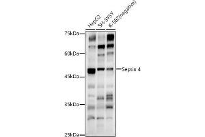 Western blot analysis of extracts of various cell lines, using Septin 4 antibody (ABIN6128476, ABIN6147554, ABIN6147555 and ABIN6214410) at 1:500 dilution. (Septin 4 抗体  (AA 1-100))