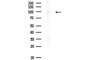 anti-Schlafen Family Member 11 (SLFN11) (N-Term) antibody