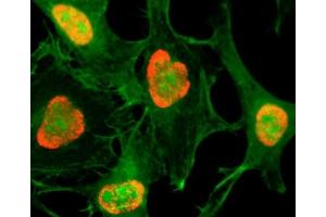 ICC testing of HeLa cells treated with sodium butyrate using recombinant H3K79ac antibody (red). (Recombinant Histone 3 抗体  (acLys79))