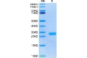 IL-6 Protein (AA 28-212) (His tag)