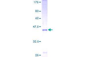 TDGF1 Protein (AA 31-188) (GST tag)