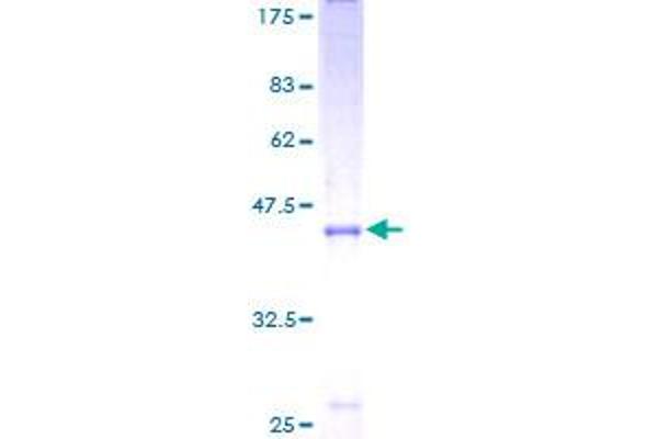 TDGF1 Protein (AA 31-188) (GST tag)