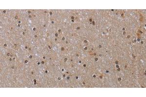Immunohistochemistry of paraffin-embedded Human brain tissue using MED12 Polyclonal Antibody at dilution 1:40 (MED12 抗体)
