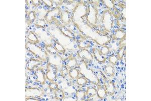 Immunohistochemistry of paraffin-embedded mouse kidney using DEPDC6 antibody (ABIN7266738) at dilution of 1:200 (40x lens). (DEPTOR 抗体  (AA 1-220))