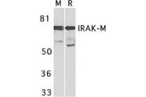 Western blot analysis of IRAK-M in mouse spleen (M) and rat liver (R) tissue lysates with AP30443PU-N IRAK-M antibody at 1 μg/ml. (IRAK3 抗体)
